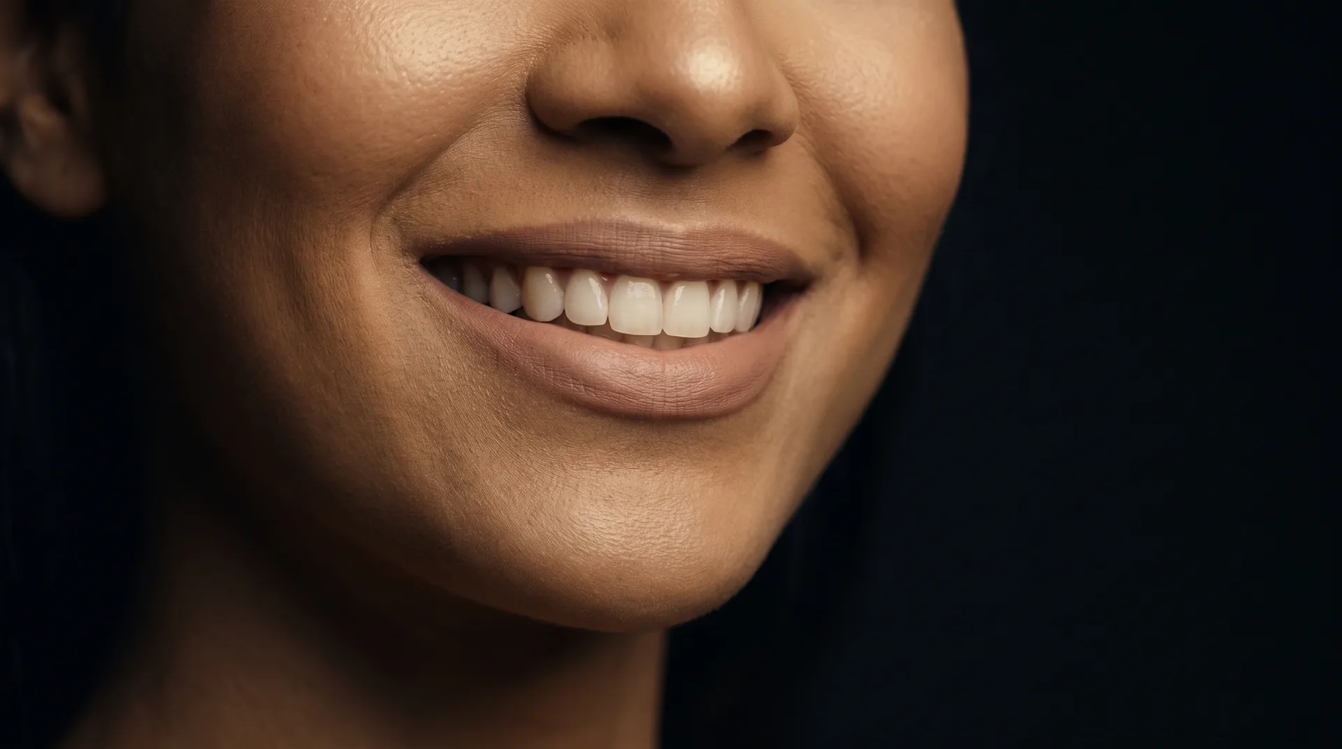 Close de um sorriso com dentes claros, depois do clareamento